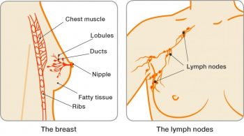 breast_lymph_nodes_lock-up_illustration_2016-compressed